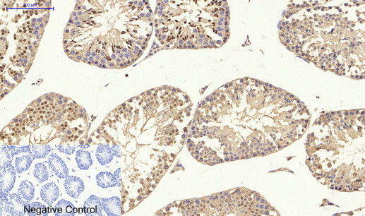 IHC - p38 Polyclonal Antibody AP71696